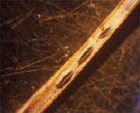 낙엽에 형성된 병원균의 자실체