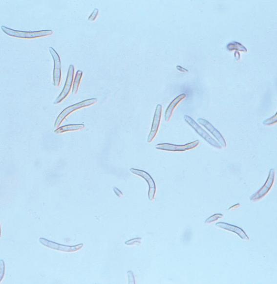 Lecanosticta acicola (Thu 이미지