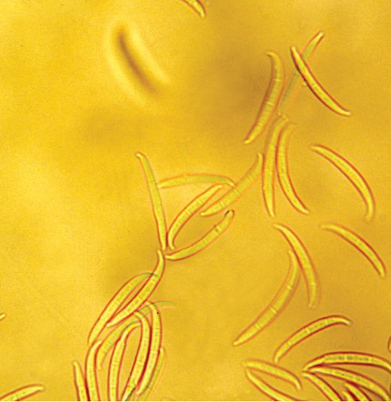 Fusarium circinatum Nirenberg &amp; O'Donnell = F. subglutinans f. sp. pini 이미지