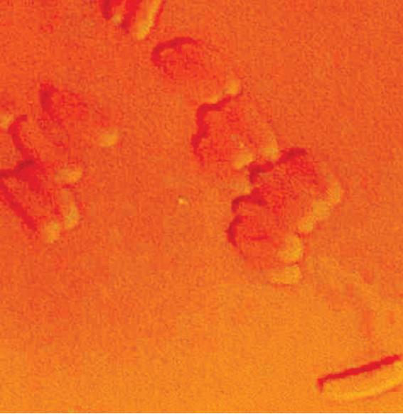 Ceratocystis sp., Ophiostoma spp., Leptographium spp.(Bluestain fungus, Ohiostomatoid fungus 이미지