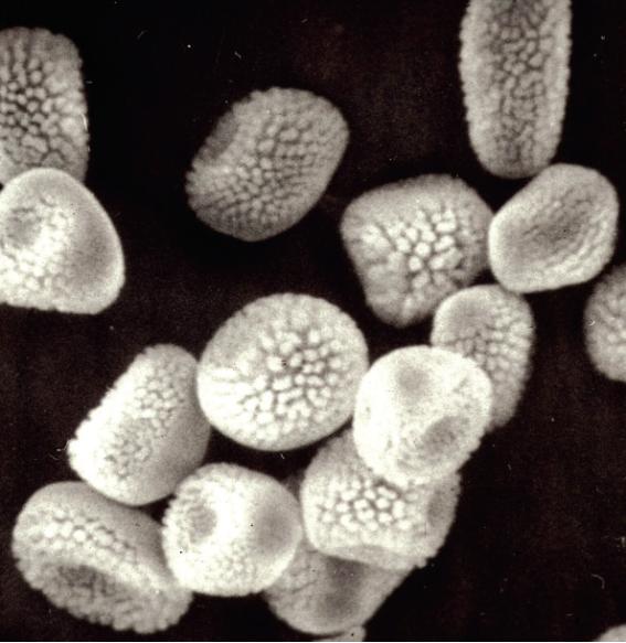 Cronartium ribicola J. C. Fischer ex Rabenhorst 이미지